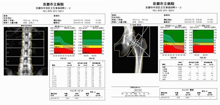 検査結果のサンプル画像