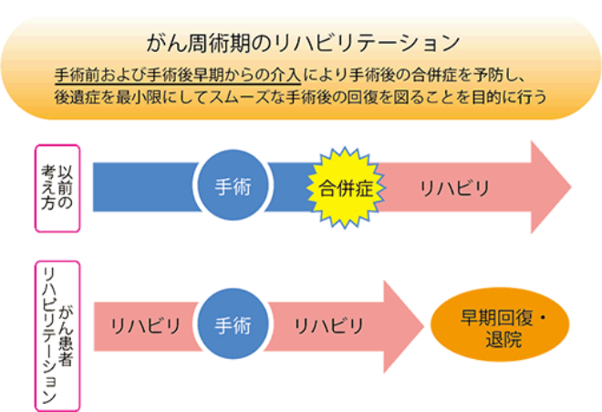 がん周術期のリハビリテーション